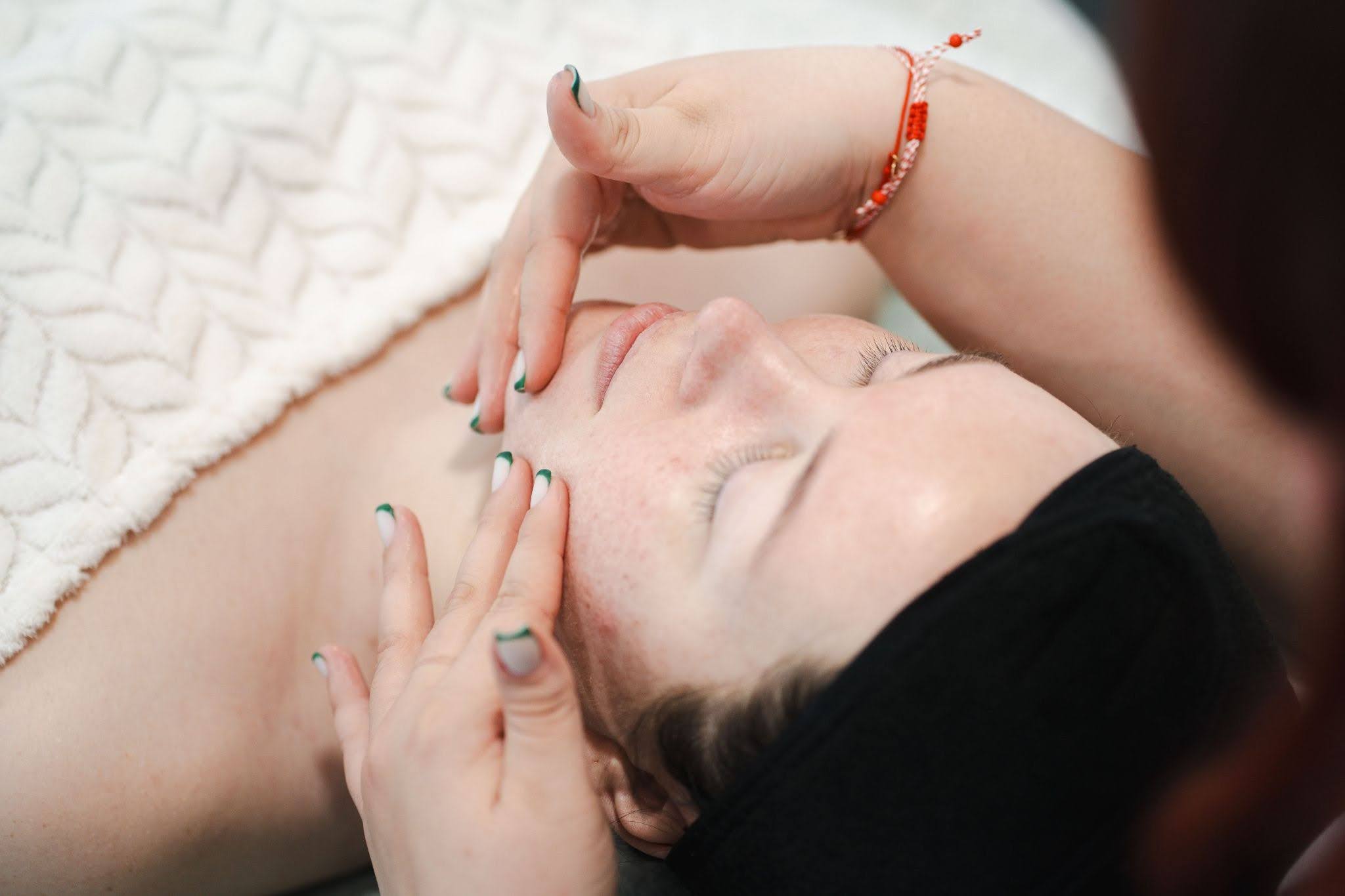 chemical peel